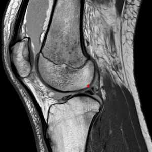 xray of the knee